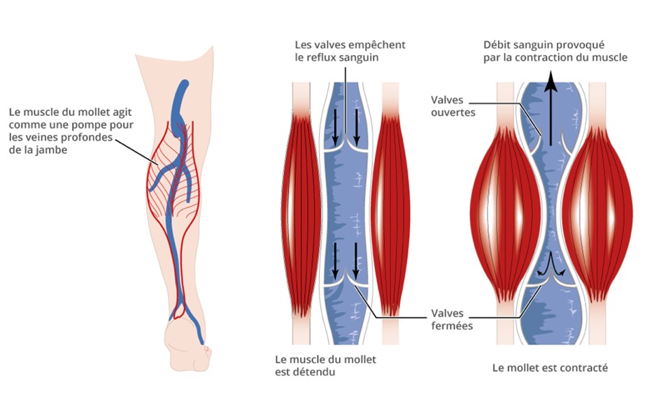 perte de tonus musculaire dans le mollet