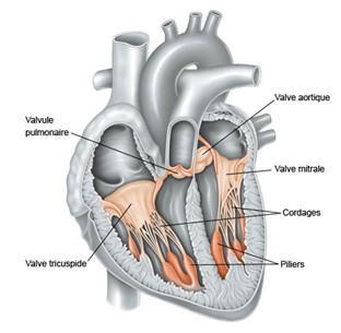  Chirurgie valvulaire cardiaque